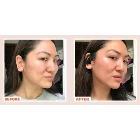 Microcurrent Face Toner – Unlock Youthful Radiance with Advanced Face and Neck Lifting Technology - Glam Global UKGlam Global UK