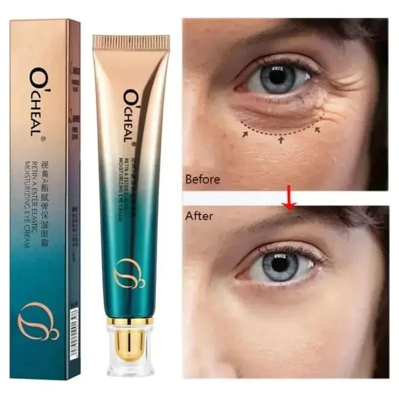 New Anti - Wrinkle Eye Cream - Glam Global UKGlam Global UK