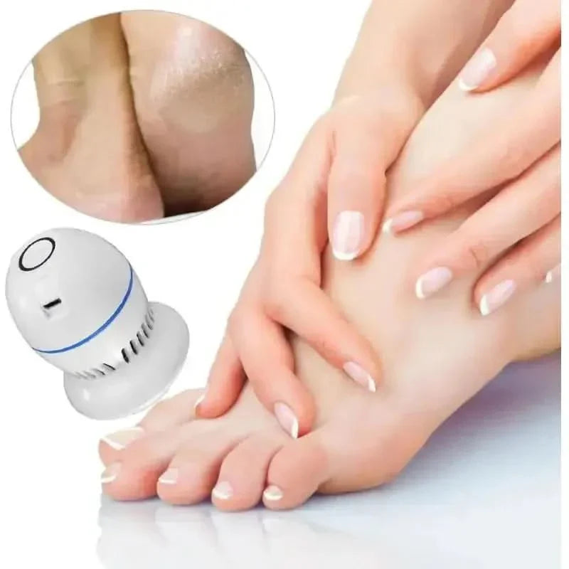 Portable Vacuum Callus Remover - Glam Global UKGlam Global UK
