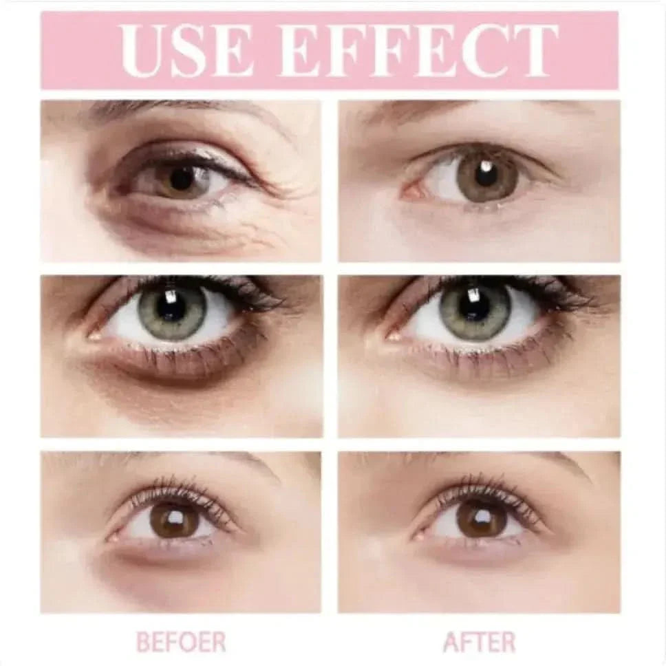 Retinol Eye Cream Stick - Glam Global UKGlam Global UK