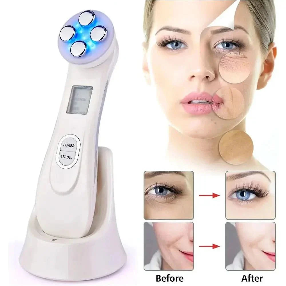 RF EMS LED Photon Facial Rejuvenation Device – Acne & Wrinkle Treatment - Glam Global UKGlam Global UK