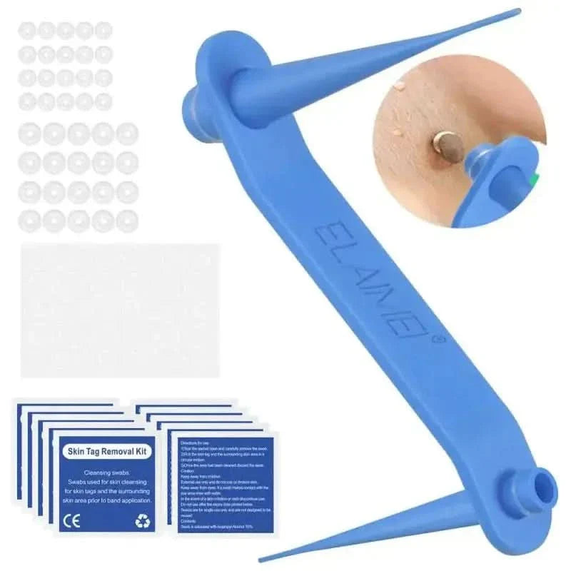 Skin Tag Remover Kit: Effortlessly Remove Skin Tags at Home - Glam Global UKGlam Global UK