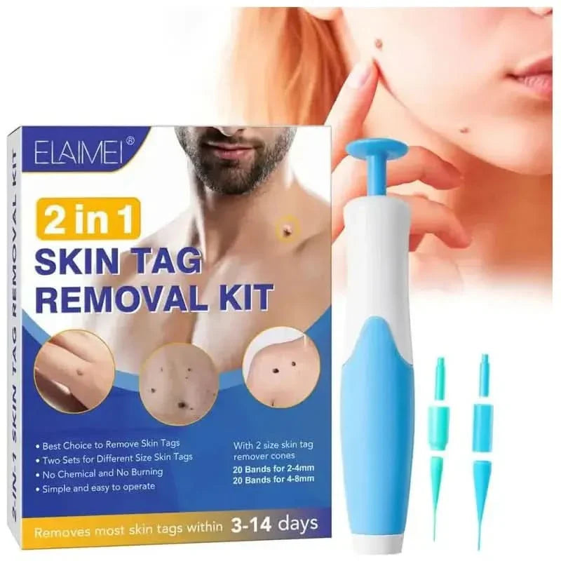 Skin Tag Remover Kit: Effortlessly Remove Skin Tags at Home - Glam Global UKGlam Global UK