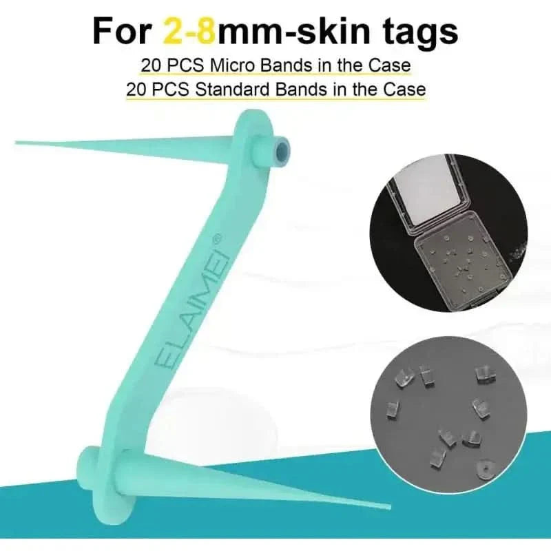 Skin Tag Remover Kit: Effortlessly Remove Skin Tags at Home - Glam Global UKGlam Global UK