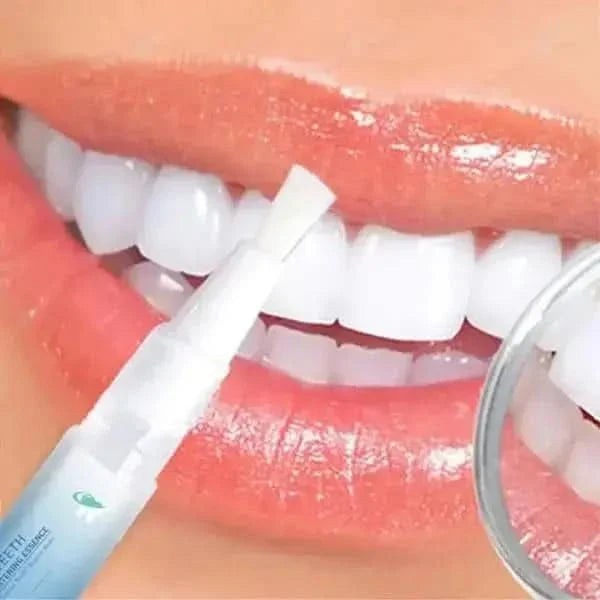 Teeth Whitening Pen – Achieve a Brighter, Radiant Smile Anywhere - Glam Global UKGlam Global UK