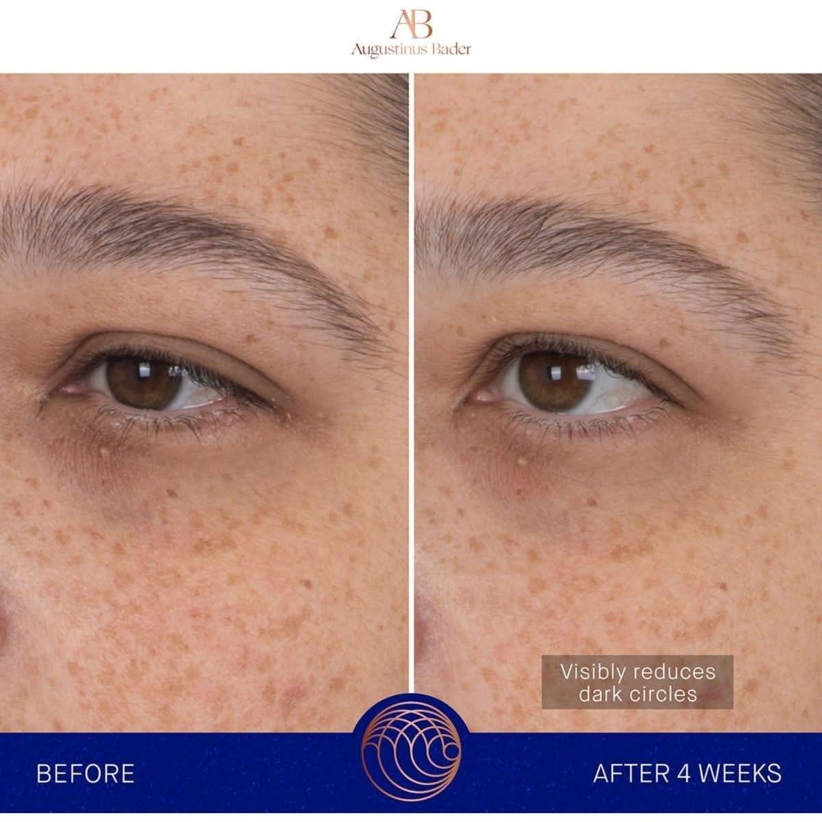 Augustinus Bader The Eye Patches | Revitalizing Hydrogel Eye Treatment - Glam Global UKAugustinus Bader