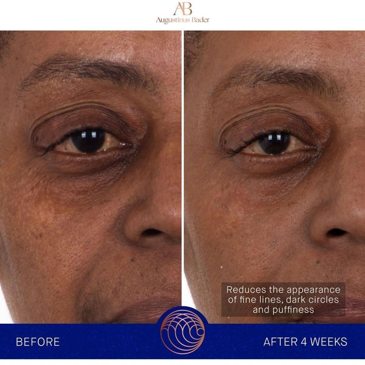 Augustinus Bader The Eye Patches | Revitalizing Hydrogel Eye Treatment - Glam Global UKAugustinus Bader