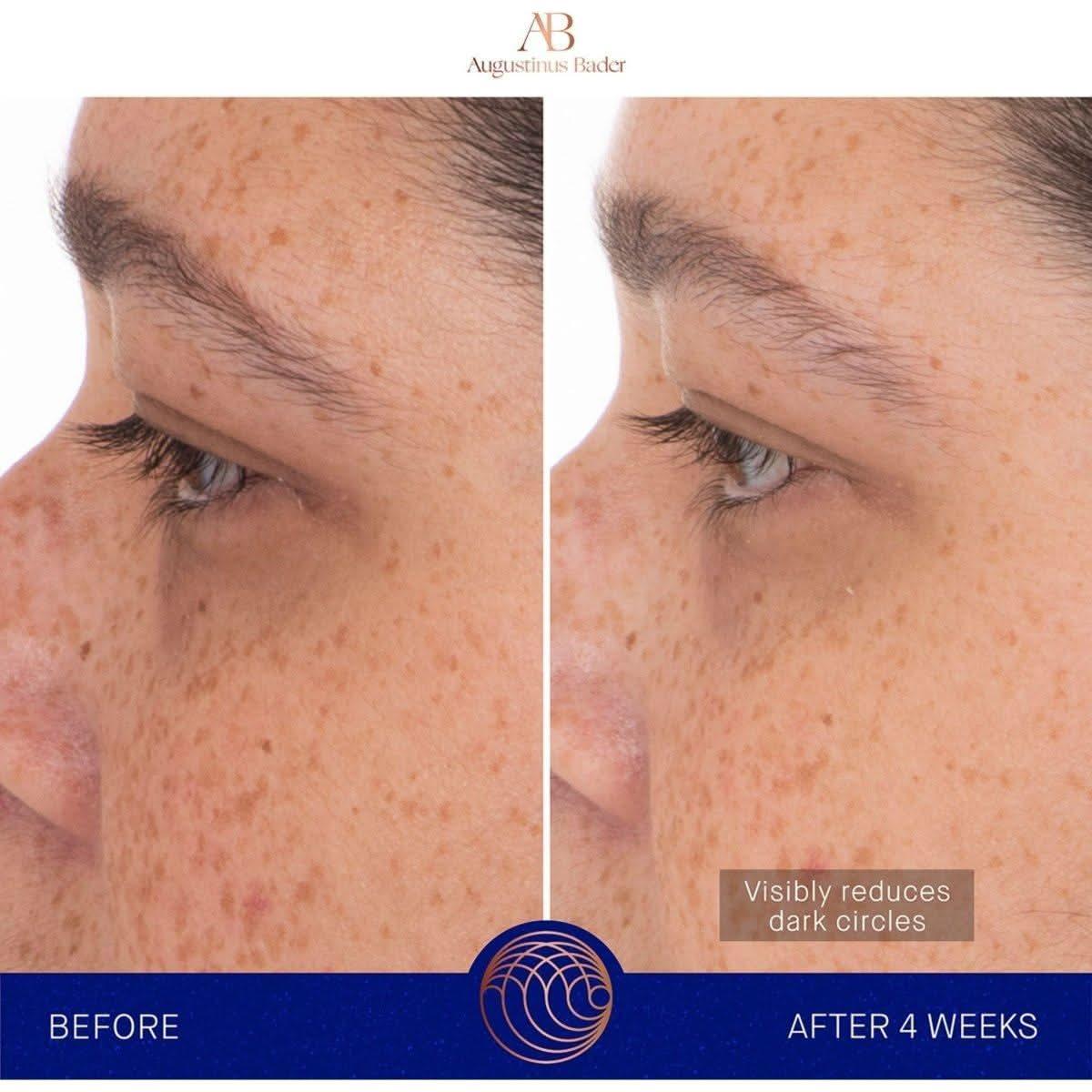 Augustinus Bader The Eye Patches | Revitalizing Hydrogel Eye Treatment - Glam Global UKAugustinus Bader