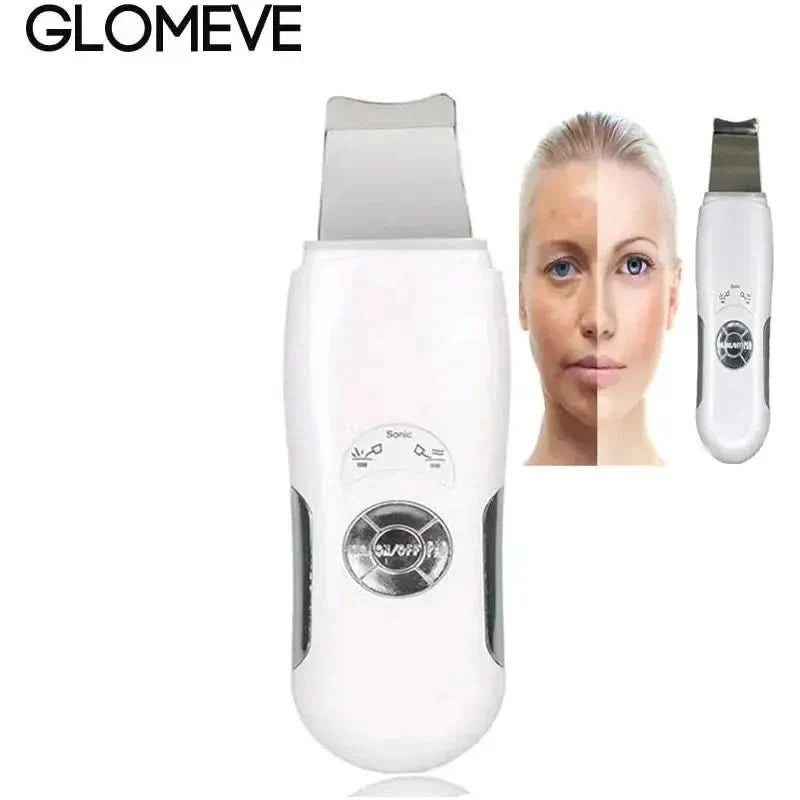 Ultrasonic Skin Scrubber Facial Cleanser - Glam Global UKGlam Global UK