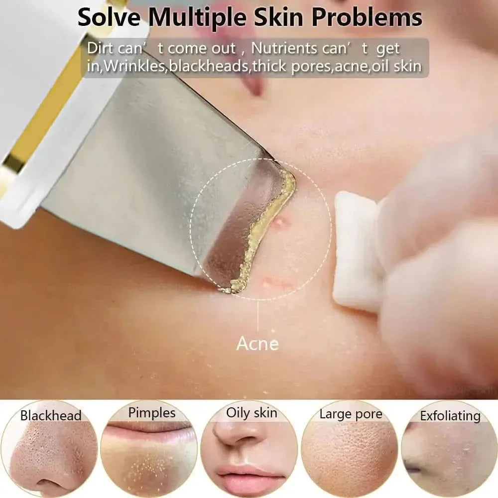 Ultrasonic Skin Scrubber: Professional Facial Cleansing Device - Glam Global UKGlam Global UK
