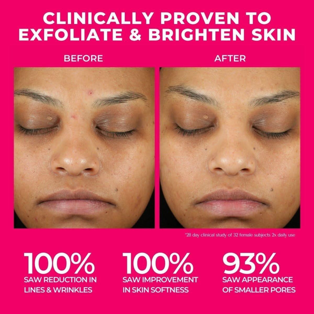 BeautyStat Universal Triple Action Daily Peel with Glucosamine and AHAs/BHAs - 10 Treatments - Glam Global UKBeautyStat