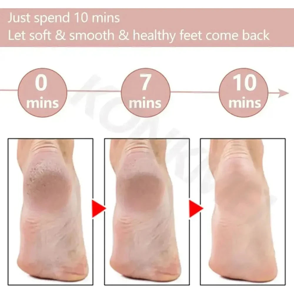 VelvetStep Foot Exfoliator – Smooth, Silky Feet at Home! - Glam Global UKGlam Global UK