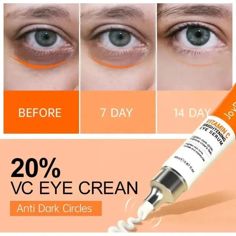 Joy Pretty Vitamin C Brightening Eye Cream – Anti - Dark Circles, Eye Bag & Puffiness Solution - Glam Global UKJoy Pretty
