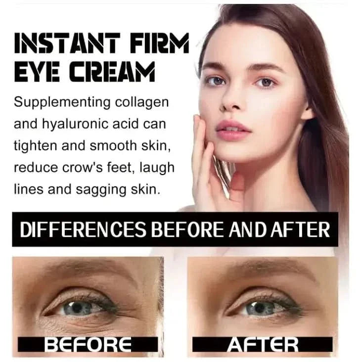 West Month Eye Bag Tightening Cream - 30ml - Glam Global UKWest Month