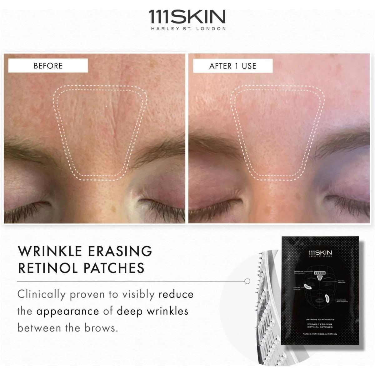 111SKIN Wrinkle Erasing Retinol Patches | Targeted Fine Line & Wrinkle Treatment (Pack of 3) - Glam Global UK111SKIN